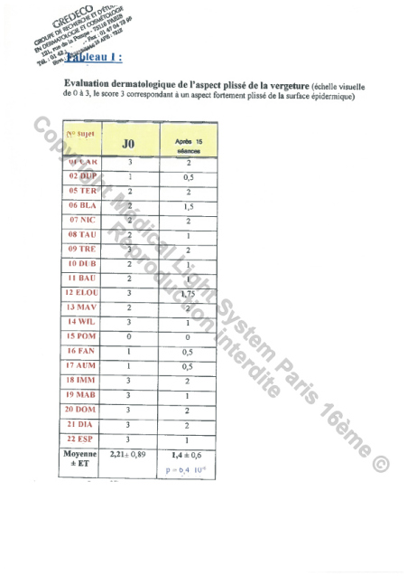 Etudes sur les vergetures : DETAILS - Tableau des mesures - Copyright Medical Light System © 2006