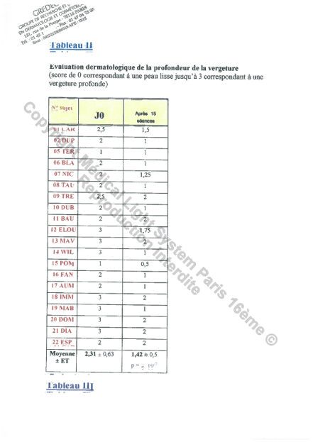 Etudes sur les vergetures : DETAILS - Tableau des mesures - Copyright Medical Light System © 2006